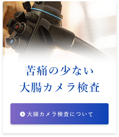 苦痛の少ない 大腸カメラ検査 大腸カメラ検査について
